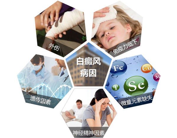 宝宝患白癜风的原因有哪些呢？