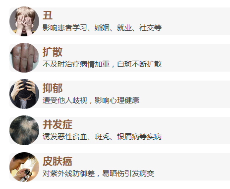 女性白癜风怎样才能有效治疗呢？