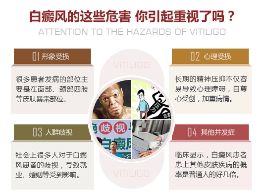 了解白癜风的三大危险