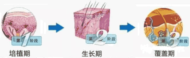 白癜风不同阶段应该如何治疗？