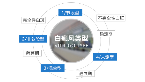老年人白癜风症状有哪些特点？