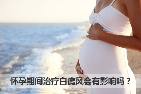 怀孕期间治疗白癜风是对胎儿有影响吗？