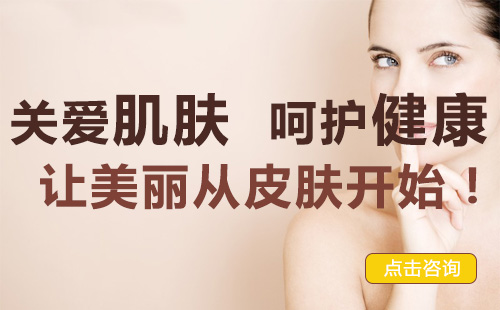 如何缓解白癜风症状？