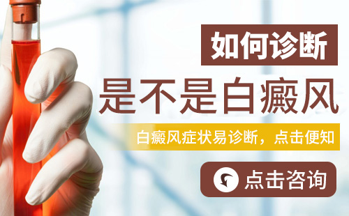 　白癜风患者在日常生活中多注意穿衣技巧