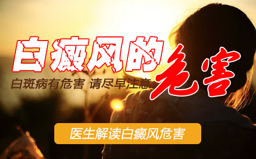 白癜风加重会有什么危害