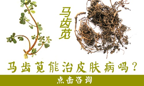 中医治疗白癜风的时间长短