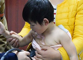 孩子白癜风好了以后会再出现吗