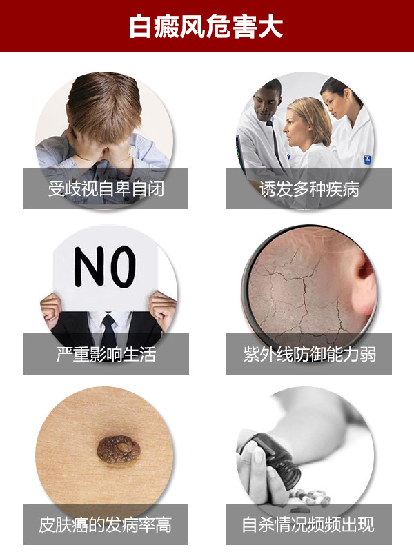 女性白癜风患者日常要注意什么？