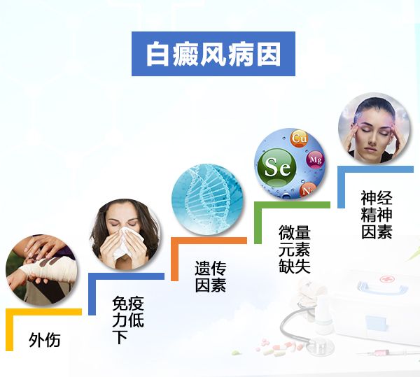 易患白癜风的人都有什么共同点