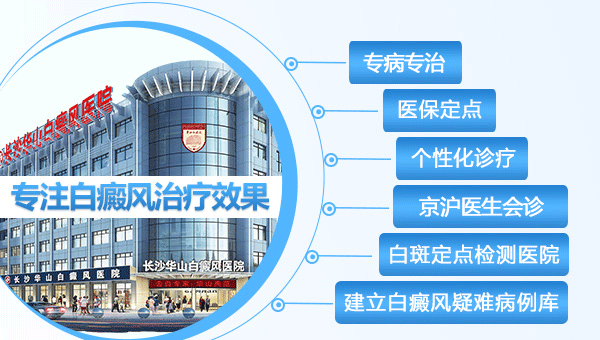 岳阳医疗白癜风需要多少钱？