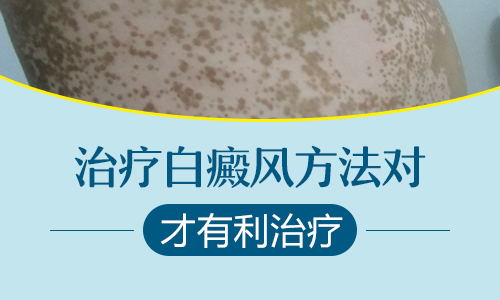 眼皮上有白点，会不会是白癜风