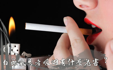白癜风患者吸烟对病情会有哪些危害