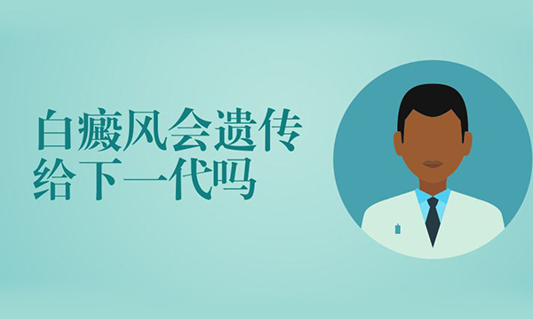 身上的白癜风会遗传吗
