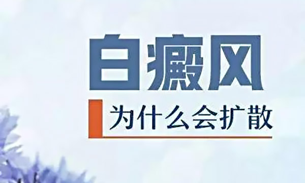 为什么白癜风会扩散