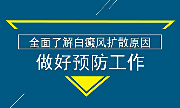 白癜风专科衡阳 手上有白斑