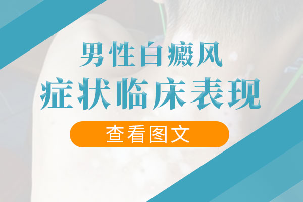 男性白癜风的治疗方法是什么？