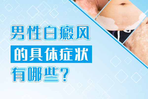 治疗男性白癜风要注意什么？