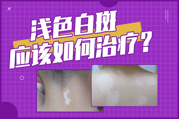 白癜风怎么治能好的更快?